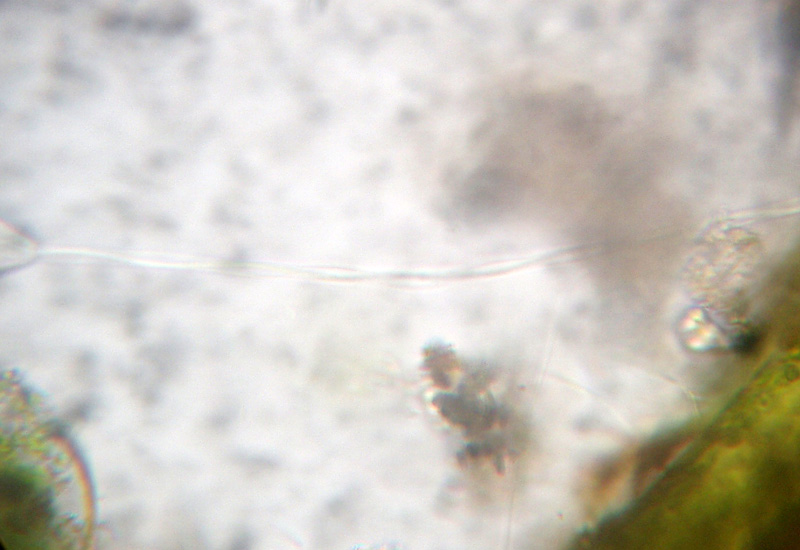 Rio del Campovecchio RE 04-10-08: Vorticella sp.